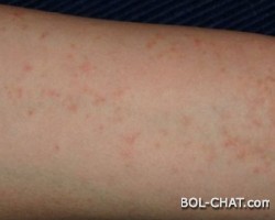 Fast 1.000 Menschen in Šugom in Bosnien und Herzegowina sind infiziert: Die kritischste in der KS - im November wurden bis zu 41 Menschen infiziert!