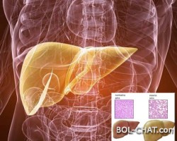 Masna jetra može biti opasna: Evo kako da uvek budete zdravi .