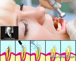 Fatal Dangers in Repaired Teeth: A terrible truth about nerve extraction has been discovered