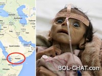 Syrien ist nichts gegen den Jemen! Sehen Sie, was die amerikanisch-saudische Koalition im Jemen getan hat